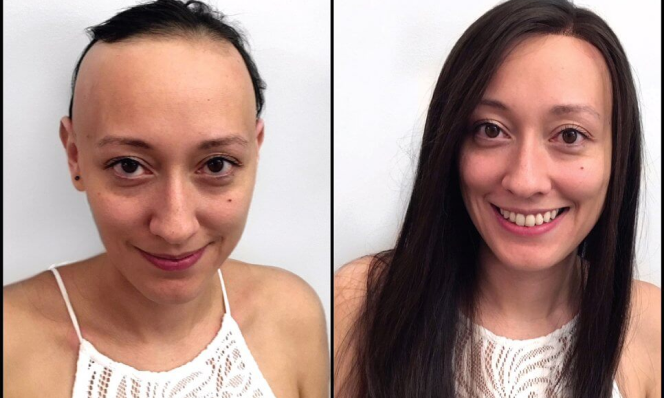Women Before After 1
