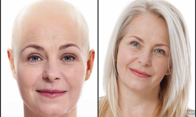 Women Before After 2