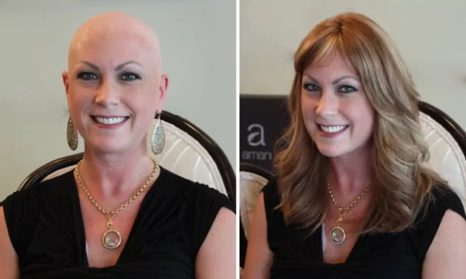 Women Before After 3